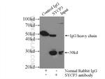 SCP3 Antibody in Immunoprecipitation (IP)