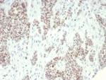 KDM1A (Nuclear Marker and Transcription Factor) Monoclonal Antibody (PCRP-KDM1A-1A10)
