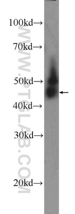 THAP11 Antibody in Western Blot (WB)