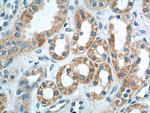 AKD1 Antibody in Immunohistochemistry (Paraffin) (IHC (P))