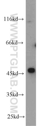 Oxytocin Receptor Antibody in Western Blot (WB)