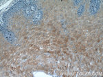 SPRR2D Antibody in Immunohistochemistry (Paraffin) (IHC (P))