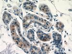SPRR2D Antibody in Immunohistochemistry (Paraffin) (IHC (P))