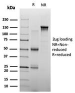 ZHX3 (Transcriptional Repressor) Antibody in SDS-PAGE (SDS-PAGE)