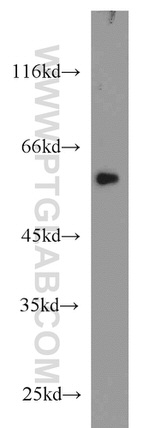FOXC2 Antibody in Western Blot (WB)