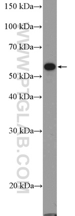 FOXC2 Antibody in Western Blot (WB)