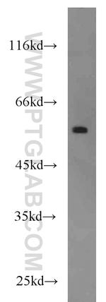 FOXC2 Antibody in Western Blot (WB)