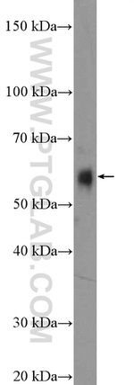 FOXC2 Antibody in Western Blot (WB)