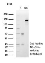 FOXO1 (Forkhead box O1) (Transcription Factor) Antibody in SDS-PAGE (SDS-PAGE)