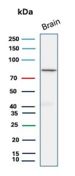 FOXO1 (Forkhead box O1) (Transcription Factor) Antibody in Western Blot (WB)