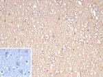 FOXO1 (Forkhead box O1) (Transcription Factor) Antibody in Immunohistochemistry (Paraffin) (IHC (P))