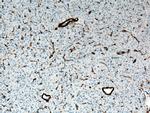 ACTA2/smooth muscle actin Antibody in Immunohistochemistry (Paraffin) (IHC (P))