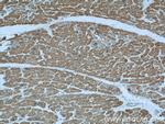 Alpha cardiac muscle actin Antibody in Immunohistochemistry (Paraffin) (IHC (P))