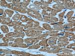 Alpha cardiac muscle actin Antibody in Immunohistochemistry (Paraffin) (IHC (P))