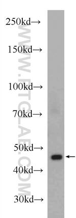 Alpha cardiac muscle actin Antibody in Western Blot (WB)