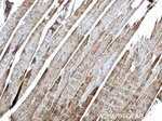 Alpha cardiac muscle actin Antibody in Immunohistochemistry (Paraffin) (IHC (P))