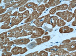 Alpha cardiac muscle actin Antibody in Immunohistochemistry (Paraffin) (IHC (P))