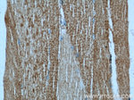 Alpha cardiac muscle actin Antibody in Immunohistochemistry (Paraffin) (IHC (P))