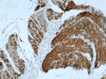 Alpha cardiac muscle actin Antibody in Immunohistochemistry (Paraffin) (IHC (P))