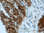 Alpha cardiac muscle actin Antibody in Immunohistochemistry (Paraffin) (IHC (P))