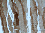Alpha cardiac muscle actin Antibody in Immunohistochemistry (Paraffin) (IHC (P))