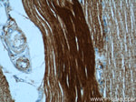 Alpha cardiac muscle actin Antibody in Immunohistochemistry (Paraffin) (IHC (P))
