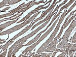 Alpha cardiac muscle actin Antibody in Immunohistochemistry (Paraffin) (IHC (P))
