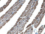Alpha cardiac muscle actin Antibody in Immunohistochemistry (Paraffin) (IHC (P))