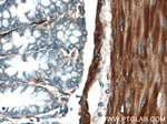 Alpha cardiac muscle actin Antibody in Immunohistochemistry (Paraffin) (IHC (P))