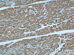 Alpha cardiac muscle actin Antibody in Immunohistochemistry (Paraffin) (IHC (P))