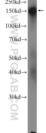DSG4 Antibody in Western Blot (WB)