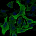 Aldo-keto Reductase Family 1 Member B1 Monoclonal Antibody (CPTC-AKR1B1-2)