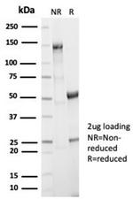 Aldo-keto Reductase Family 1 Member B1 (Adrenal Marker) Antibody in Immunoelectrophoresis (IE)