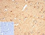 Aldo-keto Reductase Family 1 Member B1 (Adrenal Marker) Antibody in Immunohistochemistry (Paraffin) (IHC (P))
