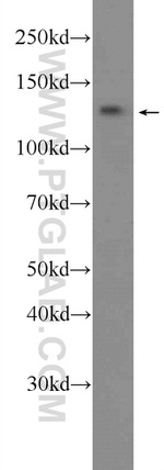 SALL2 Antibody in Western Blot (WB)