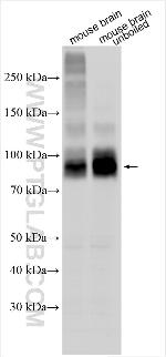 TMEM63C Antibody in Western Blot (WB)