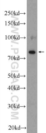 ESRP2 Antibody in Western Blot (WB)
