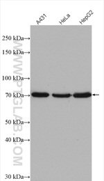 ESRP2 Antibody in Western Blot (WB)