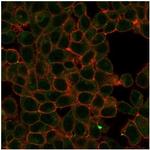 HIC2 (Hypermethylated in cancer 2) (Transcriptional Repressor) Monoclonal Antibody (PCRP-HIC2-1B1)