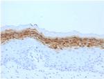 Filaggrin Monoclonal Antibody (FLG, 1561)