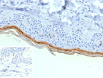 Filaggrin (Keratinocyte Differentiation Marker) Recombinant Mouse Monoclonal Antibody (r15C10)