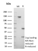 Filaggrin (Keratinocyte Differentiation Marker) Antibody in SDS-PAGE (SDS-PAGE)