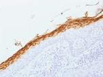 Filaggrin (Keratinocyte Differentiation Marker) Monoclonal Antibody (FLG/1562)