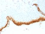 Filaggrin (Keratinocyte Differentiation Marker) Monoclonal Antibody (rFLG/1561)