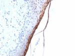 Filaggrin Recombinant Rabbit Monoclonal Antibody (FLG, 1957R)