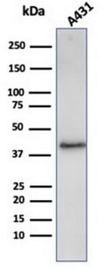 Filaggrin (Keratinocyte Differentiation Marker) Recombinant Rabbit Monoclonal Antibody (FLG/3909R)