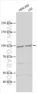 WDR36 Antibody in Western Blot (WB)