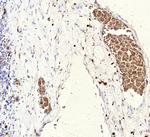 FLI1 (Ewing's Sarcoma and Endothelial Marker) Recombinant Mouse Monoclonal Antibody (rFLI1/9614)