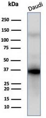 FLI1 (Ewing's Sarcoma and Endothelial Marker) Monoclonal Antibody (FLI1/3183)