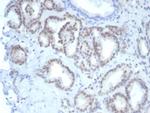 FLI1 (Ewing's Sarcoma and Endothelial Marker) Monoclonal Antibody (FLI1/7508)